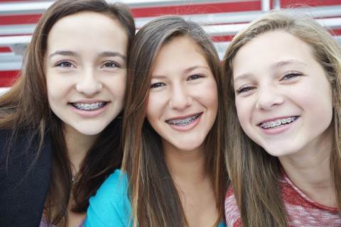 Teenage girls showing off braces together