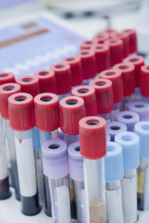 Close up of blood samples in test tube rack in laboratory