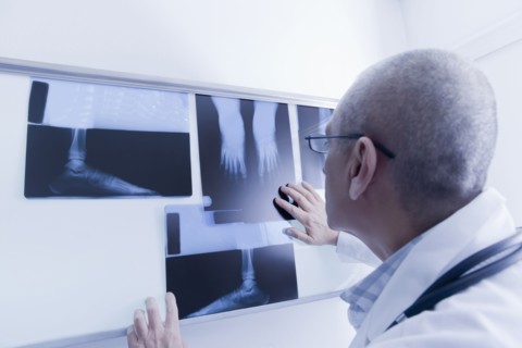 Hispanic doctor examining x-rays