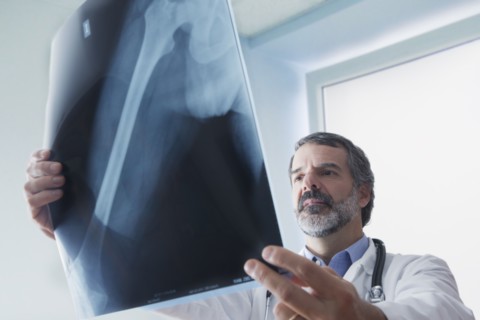 Hispanic doctor examining x-ray