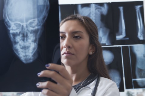 Hispanic doctor examining x-ray of skull