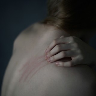 Caucasian teenage girl scratching her shoulder