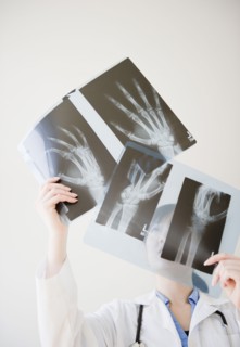 Korean doctor looking at x-rays of hand bones