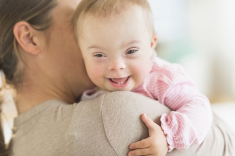 Caucasian mother holding baby girl with Down Syndrome