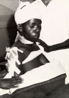 Surviving victim of the Lari massacre. A bandaged Kikuyu woman, one of the few survivors of the
