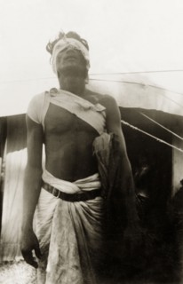 Patient at a missionary medical camp. A male patient at a Methodist mission medical camp emerges