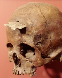 Skull of a 20 year old woman which still holds the point that killed her