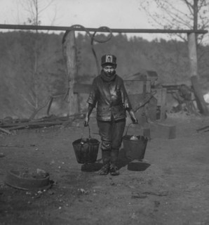 Boy with crushed leg works in the mines. 1906