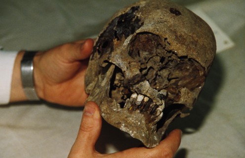 A forensic scientist examining the skull of tsar nicholas ll in yekaterinburg, russia, 1992.