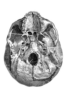 Human Skull Bones