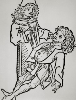 History of medicine. Modern Age. Belly infaldo. Cirrhosis. Woodcut. Hortus Sanitatis. 14th century.