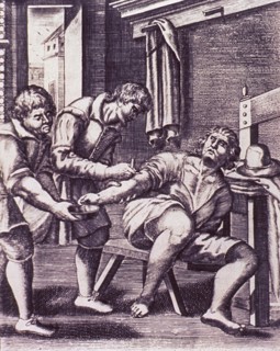 Venesection on male patient