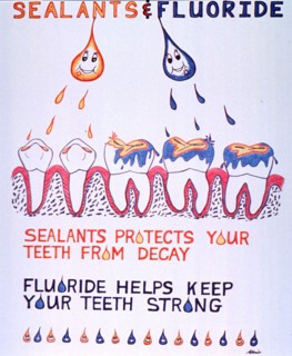 Sealants & fluoride
