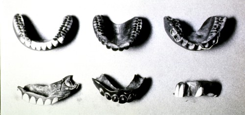 Japanese wooden dentures