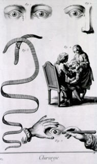 Eye maladies ca. 1700s