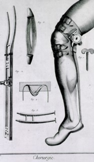 Devices for foot and leg injuries ca. 1700s