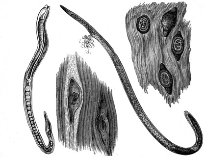 Left Male Trichinella