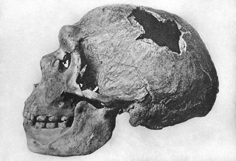 Human Skull