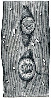 Trichina in the capsule of the muscle fibers.