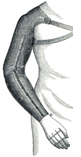 Artificial arm.