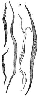 Smooth muscle cells.