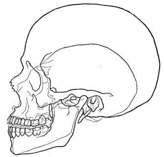 Microcephalic skull.