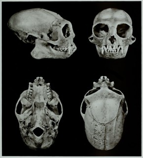 Skull Bones