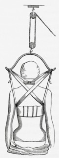 Suspension apparatus for use in spinal disease.