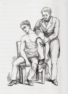Method of reducing dislocation of the shoulder with knee in armpit.