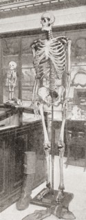 The skeletons of Charles Byrne.
