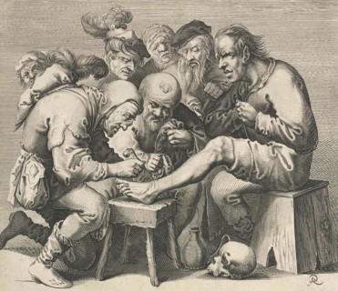 Operation on the foot for teaching purposes by a doctor in the Middle Ages many students are present.