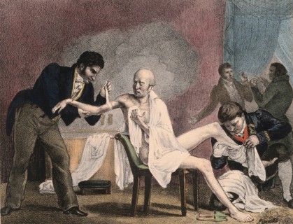 An emaciated old man being treated by four doctors, 1852, a steam bath billows in the background.