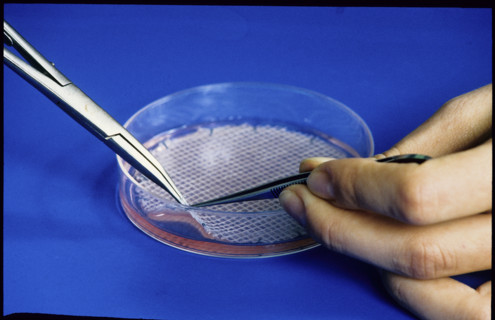 Skin cell culture in petridish 1989