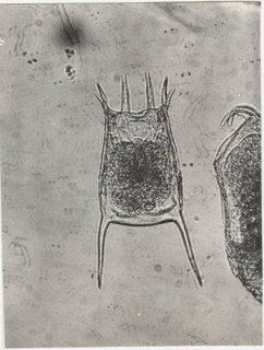 Keratella quadrata