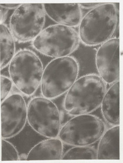 Ostracods
