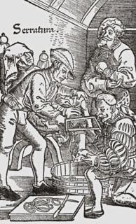 Sixteenth century amputation.