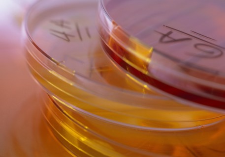 MEDICAL, Health, Laboratory, Petri dishes