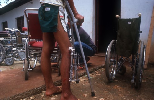CUBA, Farabundomarti, Amputees centre. Man with pin in leg with wheel chairs all around him