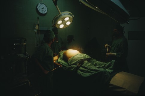 CUBA, Havana, Woman in labour lying on an operating table at the maternity hospital with lamps