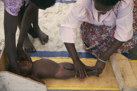 ZAMBIA, Mayukwayukwa Camp, Baby girl being measured in day feeding centre for malnourished children