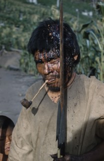 COLOMBIA, Sierra de Perija, Yuko - Motilon ., "Victim after a ritual bow fight in which aim is to