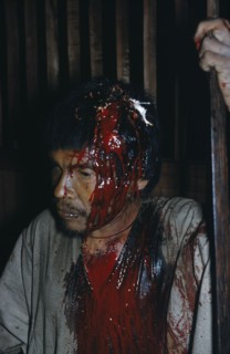 COLOMBIA, Sierra de Perija, Yuko - Motilon ., Victim of bow fight with recent deep wound to skull