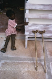 TANZANIA, Medical, Child with both legs in braces sitting in open doorway of polio unit beside pair