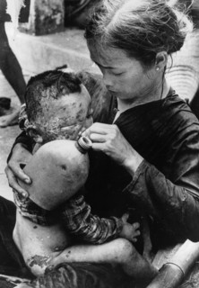VIETNAM, South, Cam Che, Badly burned Vietnamese baby caught in bursting napalm bomb between US