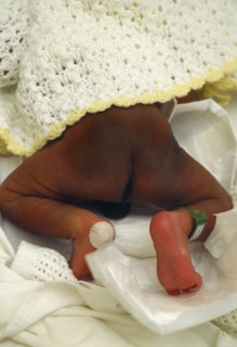 Children, Babies, New Born, Mongolian Blue mark on bottom of new born baby.